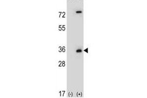 Western blot analysis of Caspase-3 antibody and 293 cell lysate (2 ug/lane) either nontransfected (Lane 1) or transiently transfected (2) with the CASP3 gene.