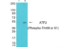Western blot analysis of extracts from 3T3 cells, using ATF-2 (Phospho-Thr69 or 51) Antibody. (ATF2 anticorps  (pThr51, pThr69))