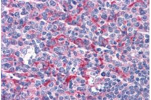 Human Tonsil: Formalin-Fixed, Paraffin-Embedded (FFPE)