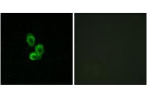 Immunofluorescence analysis of HepG2 cells, using PDGF Receptor beta (Ab-751) Antibody. (PDGFRB anticorps  (AA 718-767))