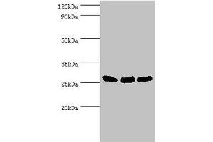 Western blot All lanes: Adenylate kinase 2, mitochondrial antibody at 5 μg/mL Lane 1: Hela whole cell lysate Lane 2: Mouse kidney tissue Lane 3: Mouse small intestine tissue Secondary Goat polyclonal to rabbit IgG at 1/10000 dilution Predicted band size: 27, 26, 23, 15, 25, 22 kDa Observed band size: 27 kDa (Adenylate Kinase 2 anticorps  (AA 1-232))