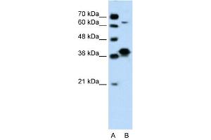 WB Suggested Anti-FOSL1 Antibody Titration: 0. (FOSL1 anticorps  (Middle Region))