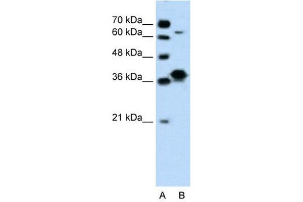 FOSL1 antibody  (Middle Region)