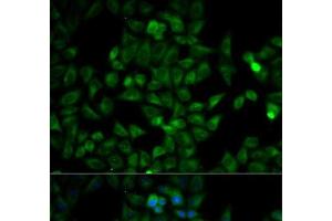 Immunofluorescence analysis of HeLa cells using TPI1 Polyclonal Antibody (TPI1 anticorps)