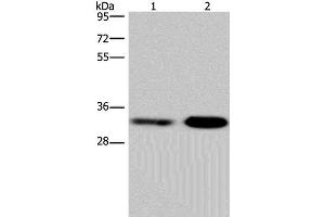 Western Blot analysis of Jurkat and NIH/3T3 cell using CDK5 Polyclonal Antibody at dilution of 1:300 (CDK5 anticorps)