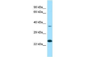 Western Blotting (WB) image for anti-Ependymin Related Protein 1 (Zebrafish) (EPDR1) (N-Term) antibody (ABIN2789381)