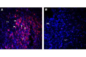 Expression of Orexin Receptor 1 in mouse locus coeruleus (LC)Immunohistochemical staining of perfusion-fixed frozen mouse brain sections with Guinea Pig Anti-Orexin Receptor 1 Antibody (ABIN7581897), (1:300), followed by goat anti-guinea pig-Alexa Fluor-594.