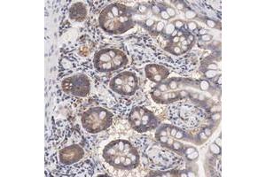 Immunohistochemical staining of human small intestine with SETD3 polyclonal antibody  shows moderate cytoplasmic positivity in glandular cells. (SETD3 anticorps)