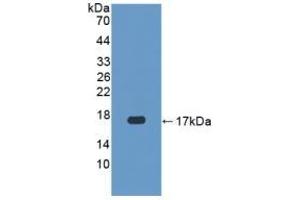 Detection of Recombinant CASP3, Human using Polyclonal Antibody to Caspase 3 (CASP3)