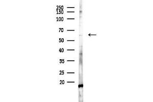 anti-Polyamine Oxidase (Exo-N4-Amino) (PAOX) (Internal Region) antibody