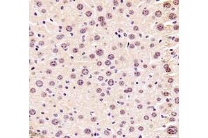Immunohistochemistry of paraffin embedded mouse liver using ZKSCAN4 (ABIN7076265) at dilution of 1:1300 (400x lens)