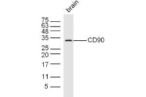 Mouse brain lysates probed with CD90 Polyclonal Antibody, Unconjugated  at 1:300 dilution and 4˚C overnight incubation.