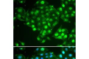 Immunofluorescence analysis of HeLa cells using ABCA3 Polyclonal Antibody (ABCA3 anticorps)
