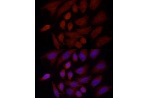 Immunofluorescence analysis of HeLa cells using SREBF1 Rabbit pAb (ABIN7270598) at dilution of 1:100 (40x lens).