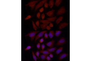 Immunofluorescence analysis of HeLa cells using SREBF1 Rabbit pAb (ABIN7270598) at dilution of 1:100 (40x lens). (SREBF1 anticorps  (AA 1-100))