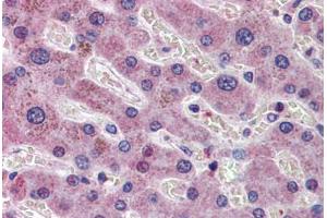 Human Liver: Formalin-Fixed, Paraffin-Embedded (FFPE)