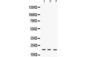 Western blot analysis of IL7 expression in mouse brain extract (lane 1), mouse thymus extract (lane 2) and NIH3T3 whole cell lysates (lane 3). (IL-7 anticorps  (AA 26-154))