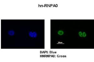 Sample Type :  MCF7 cells   Primary Antibody Dilution :   1:200   Secondary Antibody:  Anti-rabbit-FITC   Secondary Antibody Dilution:   1:500   Color/Signal Descriptions:  DAPI: Blue hn-RNPA0: Green   Gene Name:  HNRPA0   Submitted by:  Anonymous (HNRNPA0 anticorps  (Middle Region))