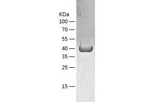 Western Blotting (WB) image for Keratin 20 (KRT20) (AA 2-424) protein (His tag) (ABIN7123676) (KRT20 Protein (AA 2-424) (His tag))