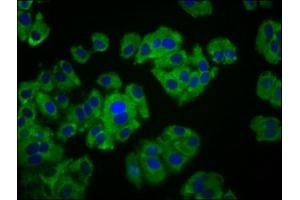 Immunofluorescence staining of HepG2 cells with ABIN7165474 at 1:133, counter-stained with DAPI. (ITFG3 anticorps  (AA 115-251))