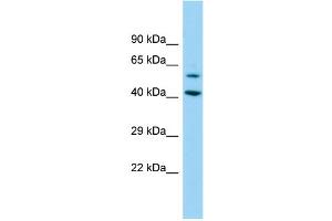 Host: Rabbit Target Name: DEPDC1B Sample Type: 293T Whole Cell lysates Antibody Dilution: 1. (DEPDC1B anticorps  (N-Term))