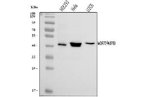 Western blot analysis of WDR77 using anti-WDR77 antibody (ABIN7599934).