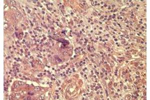 Image no. 3 for anti-Wingless-Type MMTV Integration Site Family, Member 5A (WNT5A) (AA 190-230) antibody (ABIN207746)