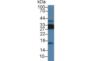 Detection of CD74 in Rat Spleen lysate using Polyclonal Antibody to Cluster Of Differentiation 74 (CD74) (CD74 anticorps  (AA 65-277))