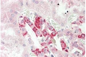 Human Kidney: Formalin-Fixed, Paraffin-Embedded (FFPE) (CUTA anticorps  (AA 71-120))