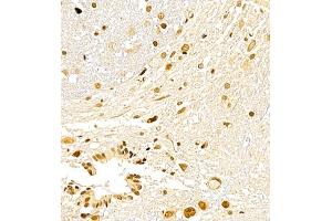 Immunohistochemistry of paraffin embedded rat spinal cord using USP27 (ABIN7076113) at dilution of 1:700 (400x lens) (USP27X anticorps)