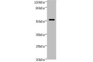 Western blot All lanes: STARD3 Antibody at 6 μg/mL + MCF-7 whole cell lysate Secondary Goat polyclonal to rabbit IgG at 1/10000 dilution Predicted band size: 51, 49, 50 kDa Observed band size: 51 kDa