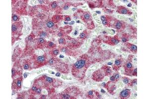 IHC Information: Liver, Human: Formalin-Fixed, Paraffin-Embedded (FFPE) (ACAA1 anticorps  (N-Term))