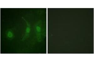 Immunofluorescence analysis of HeLa cells, using IRF-3 (Phospho-Ser385) Antibody. (IRF3 anticorps  (pSer385))