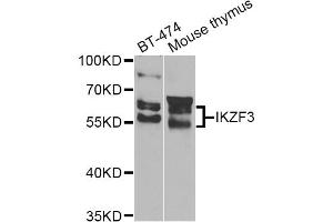 Western blot analysis of extracts of various cell lines, using IKZF3 Antibody (ABIN4904027) at 1:1000 dilution. (IKZF3 anticorps)