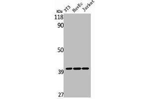 Western Blot analysis of NIH-3T3 HuvEc Jurkat cells using MAGE-C2 Polyclonal Antibody (MAGEC2 anticorps  (Internal Region))