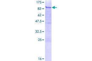 Image no. 1 for Microphthalmia-Associated Transcription Factor (MITF) (AA 1-520) protein (GST tag) (ABIN1310958)