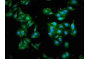Immunofluorescence staining of HepG2 cells with ABIN7153511 at 1:93, counter-stained with DAPI. (GABARAP anticorps  (AA 2-117))