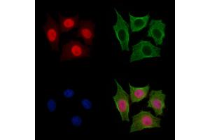 Anillin Antibody staining HepG2 cells by IF/ICC. (Anillin anticorps  (C-Term))