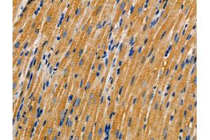 ABIN6259854 and ABIN6266844 at 1/100 staining Rat heart tissue by IHC-P. (AKAP3 anticorps  (Internal Region))