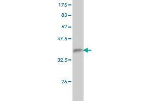 Western Blot detection against Immunogen (35.