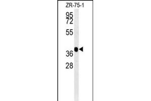 NIL2 Antibody (N-term) (ABIN651598 and ABIN2840315) western blot analysis in ZR-75-1 cell line lysates (35 μg/lane). (NIPAL2 anticorps  (N-Term))