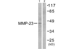 Western Blotting (WB) image for anti-Matrix Metallopeptidase 23 (MMP23) (C-Term) antibody (ABIN1848685) (Matrix Metallopeptidase 23 (MMP23) (C-Term) anticorps)