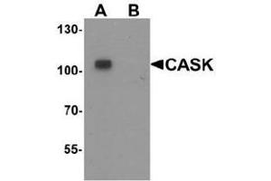 Western blot analysis of CASK in mouse brain tissue lysate with CASK antibody at 1 ug/ml in (A) the absence and (B) the presence of blocking peptide.