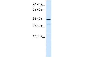 Human Lung; WB Suggested Anti-TCFL1 Antibody Titration: 0.