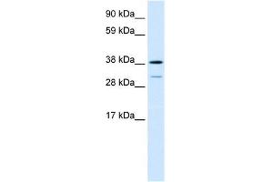 Human Lung; WB Suggested Anti-TCFL1 Antibody Titration: 0. (VPS72 anticorps  (Middle Region))