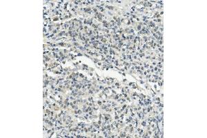IHC analysis of UBE3A using anti-UBE3A antibody (ABIN7599562). (ube3a anticorps  (AA 1-860))