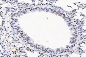 Immunohistochemistry analysis of paraffin-embedded mouse lung using,SET (ABIN7075583) at dilution of 1: 10000