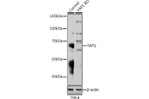 Western blot analysis of extracts from normal (control) and Y Rabbit pAb knockout (KO) HeLa cells, using Y Rabbit pAb antibody (ABIN6132788, ABIN6150316, ABIN6150321 and ABIN6215135) at 1:1000 dilution. (YAP1 anticorps  (AA 155-504))