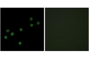Immunofluorescence analysis of HepG2 cells, using Centromeric Protein A (Ab-7) Antibody.