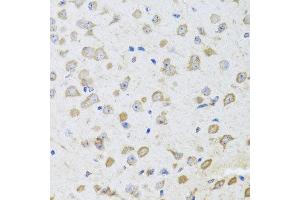 Immunohistochemistry of paraffin-embedded mouse brain using ARL6 antibody at dilution of 1:100 (x40 lens).